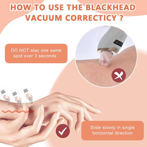 Vacuum Blackhead Remover Face Black Spots Cleaner White Dot Pimple Removal